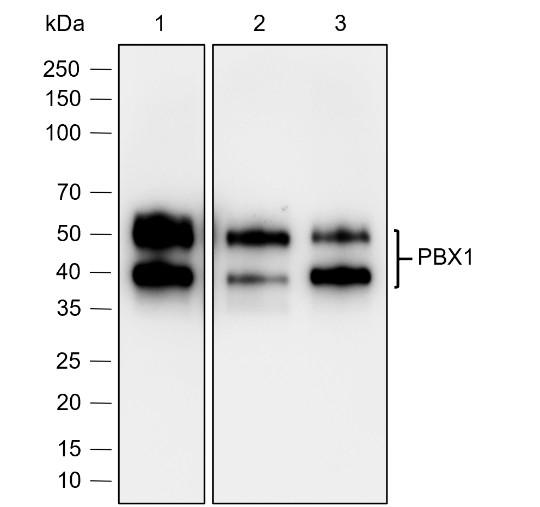 Recombinant PBX1 Monoclonal Antibody (AN302057L)