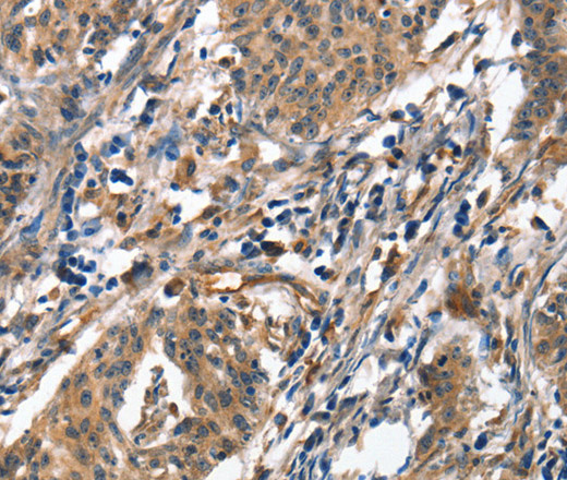 ALOX15 Polyclonal Antibody (E-AB-16237)