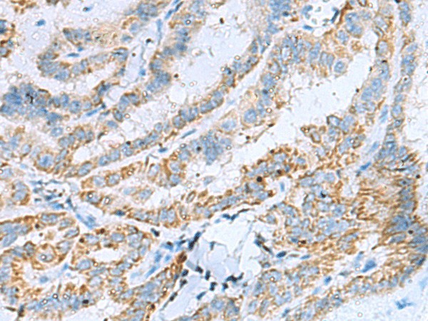 KIF5A Polyclonal Antibody (E-AB-18195)