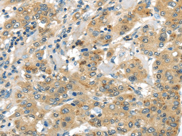 UTS2B Polyclonal Antibody (E-AB-17538)