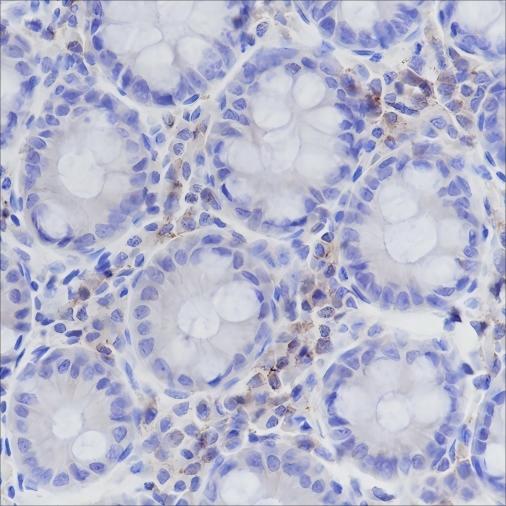 Recombinant CD50/ICAM3 Monoclonal Antibody (AN301481L)