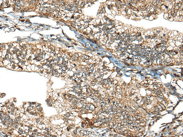 CALHM1 Polyclonal Antibody (E-AB-52511)