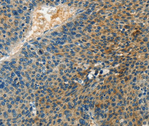 DGK beta Polyclonal Antibody (E-AB-16209)