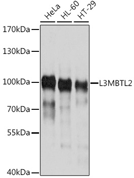 L3MBTL2 Polyclonal Antibody (E-AB-63350)