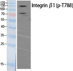 Phospho-ITGB1 (Thr788) Polyclonal Antibody (E-AB-20904)