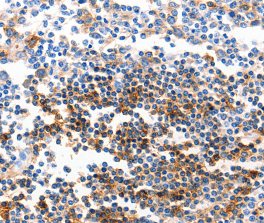 GJB6 Polyclonal Antibody (E-AB-15680)