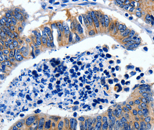 GAD2 Polyclonal Antibody (E-AB-15661)