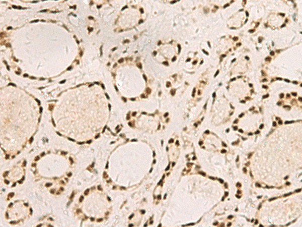 SAP30BP Polyclonal Antibody (E-AB-53136)