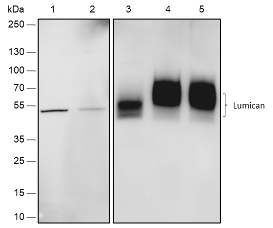 Recombinant Lumican Monoclonal Antibody (AN301840L)