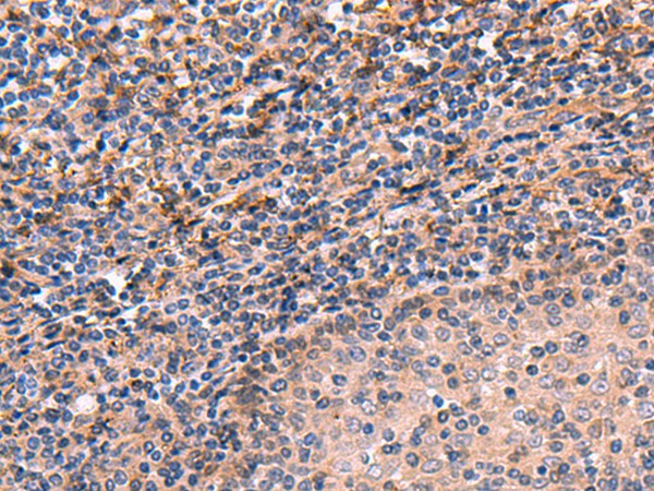 ARIH2 Polyclonal Antibody (E-AB-52978)
