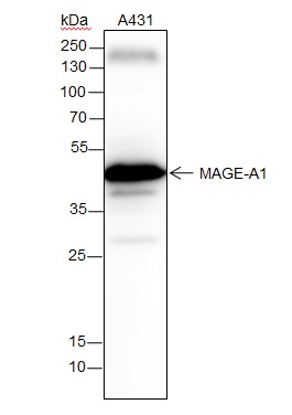 Recombinant MAGEA1 Monoclonal Antibody (AN301594L)