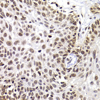 PHIP Polyclonal Antibody (E-AB-61584)