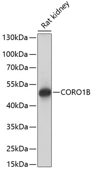 CORO1B Polyclonal Antibody (E-AB-65046)