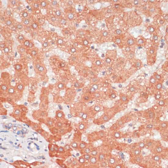 ATG5 Polyclonal Antibody (E-AB-65820)