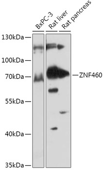 ZNF460 Polyclonal Antibody (E-AB-91838)