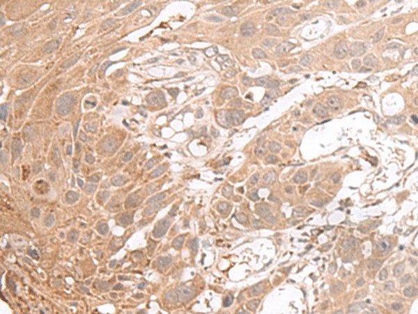 CHST4 Polyclonal Antibody (E-AB-17931)