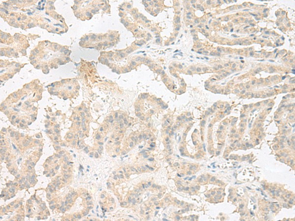 EPRS Polyclonal Antibody (E-AB-18006)