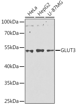 GLUT3 Polyclonal Antibody (E-AB-67954)