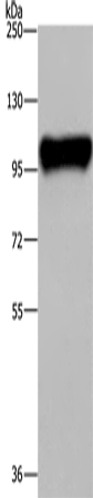 PTK2B Polyclonal Antibody (E-AB-15011)
