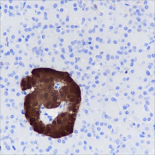Recombinant SCGN Monoclonal Antibody (AN301654L)
