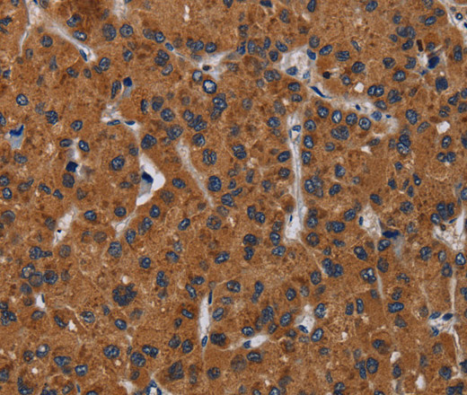 KLK8 Polyclonal Antibody (E-AB-15163)