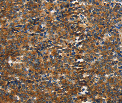 PIK3R4 Polyclonal Antibody (E-AB-16201)