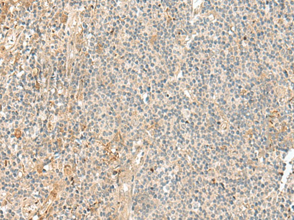 NGEF Polyclonal Antibody (E-AB-18859)