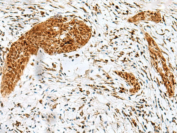HMG20A Polyclonal Antibody (E-AB-18685)