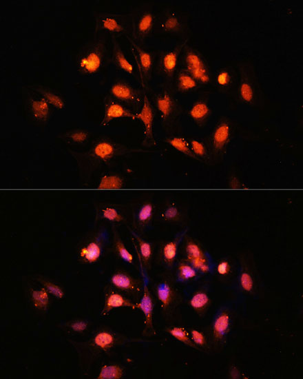 PHLPP1 Polyclonal Antibody (E-AB-63965)