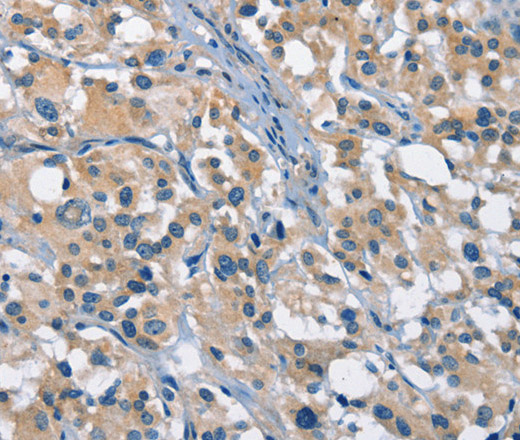 GAS2 Polyclonal Antibody (E-AB-10339)