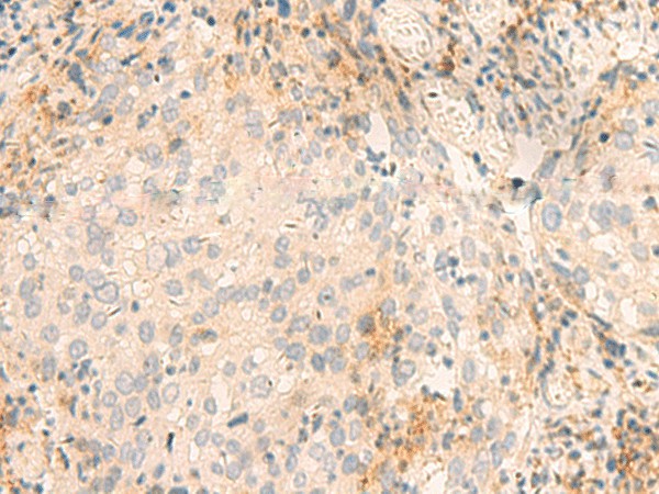 GSKIP Polyclonal Antibody (E-AB-52808)