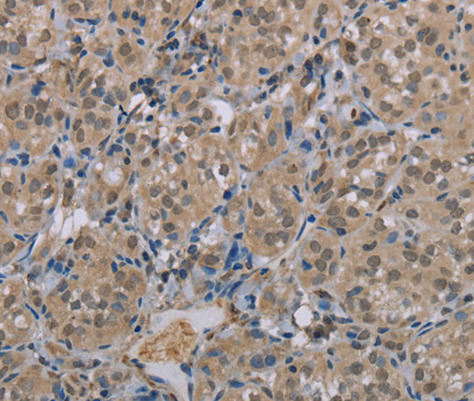 MGLL Polyclonal Antibody (E-AB-13423)