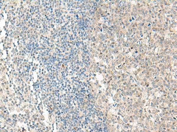 NPBWR1 Polyclonal Antibody (E-AB-19945)
