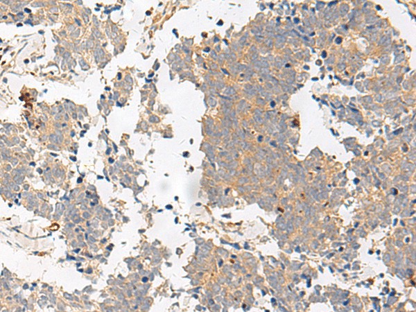 GPR153 Polyclonal Antibody (E-AB-18038)