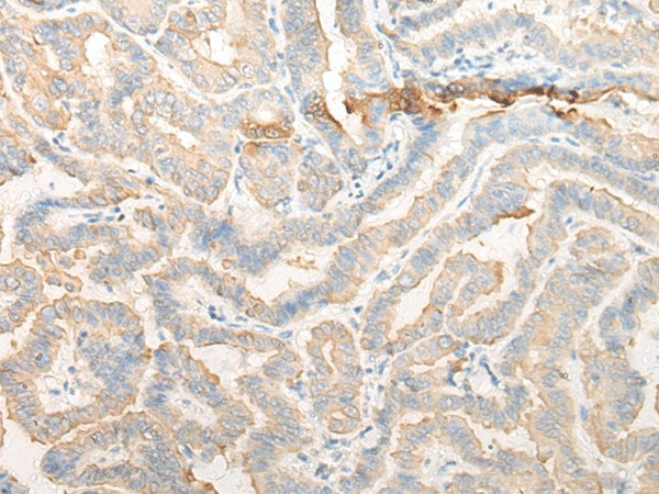CELA3A Polyclonal Antibody (E-AB-52588)