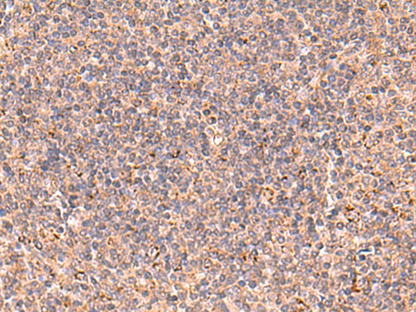 UBAC1 Polyclonal Antibody (E-AB-52937)