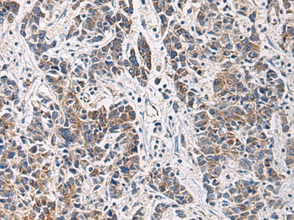 HSDL2 Polyclonal Antibody (E-AB-53157)