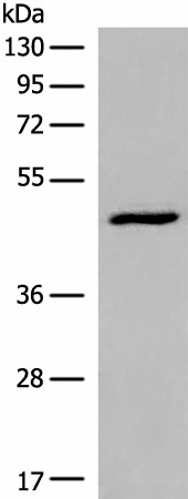 DCP2 Polyclonal Antibody (E-AB-18644)