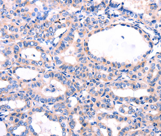 DUSP12 Polyclonal Antibody (E-AB-14070)