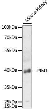 PIM1 Polyclonal Antibody (E-AB-66245)