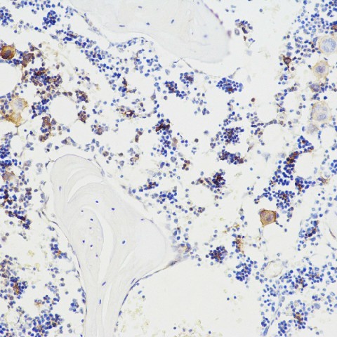 BGLAP Polyclonal Antibody (E-AB-70096)