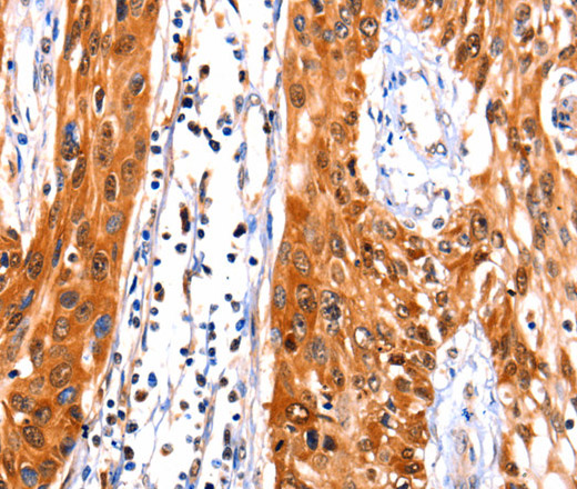 FBLN1 Polyclonal Antibody (E-AB-12407)
