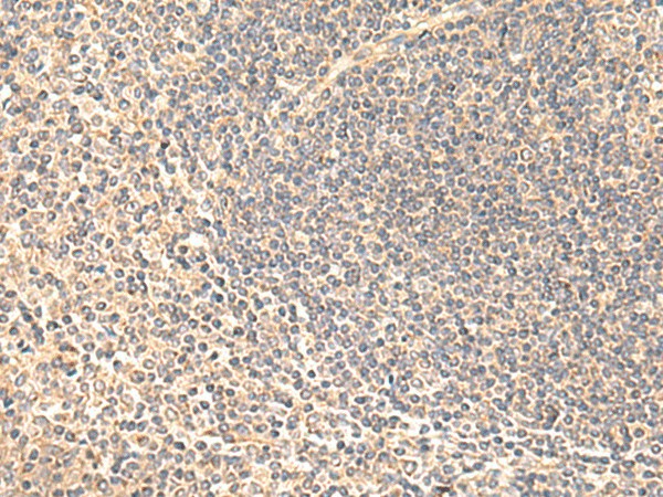 SULT4A1 Polyclonal Antibody (E-AB-18956)