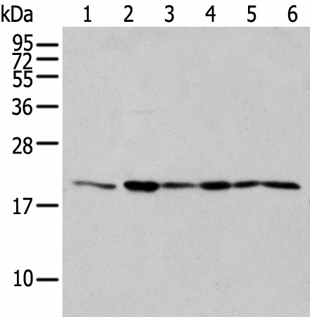 EEF1E1 Polyclonal Antibody (E-AB-52323)