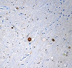 Purified anti-α-Synuclein (C-Terminal Truncated x-122) Antibody (848401)