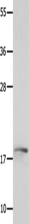 NME3 Polyclonal Antibody (E-AB-14251)