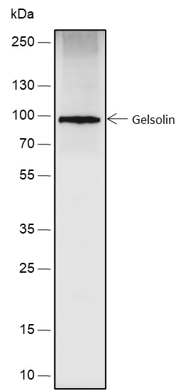 Recombinant Gelsolin Monoclonal Antibody (AN301824L)