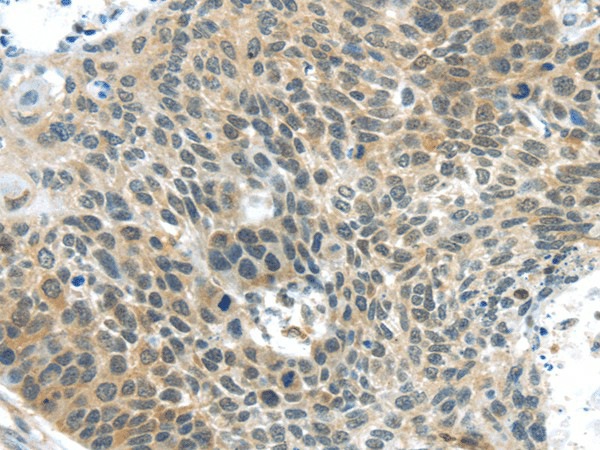 TSPY1 Polyclonal Antibody (E-AB-17477)