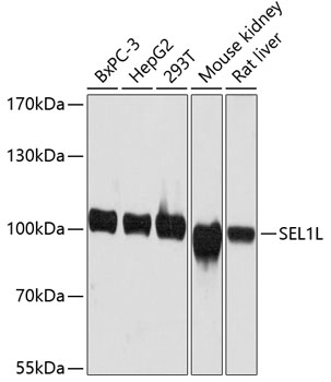 SEL1L Polyclonal Antibody (E-AB-63621)