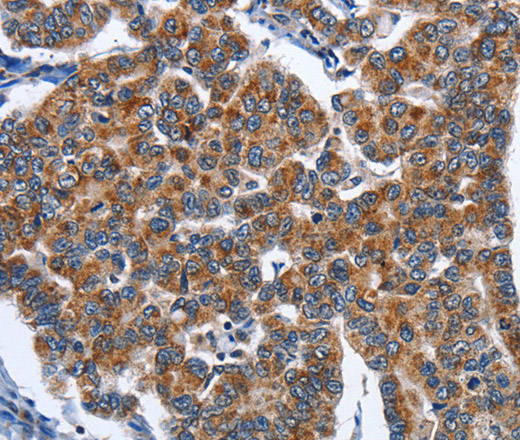 CADM3 Polyclonal Antibody (E-AB-11019)
